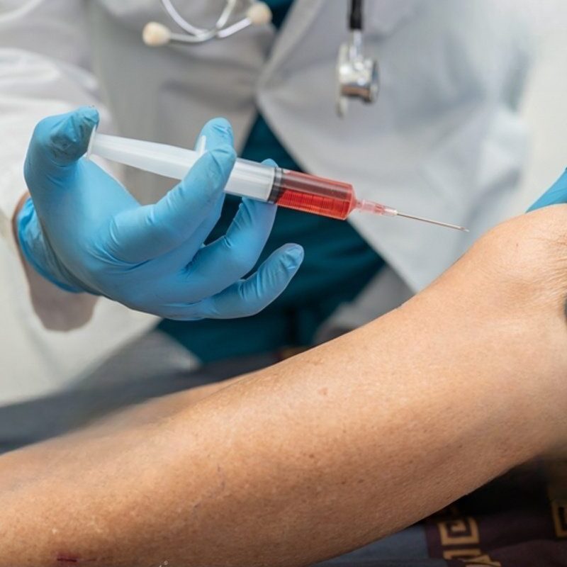 Aplicação de ácido hialurônico nas articulações